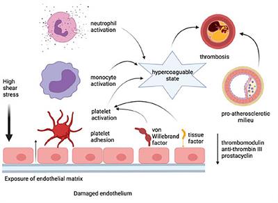 Emerging Role of Platelet-Endothelium Interactions in the Pathogenesis of Severe SARS-CoV-2 Infection-Associated Myocardial Injury